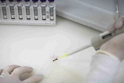 exames-descartam-ebola-em-imigrante-da-republica-democratica-do-congo