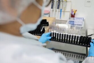 malaria:-anvisa-autoriza-teste-em-humanos-de-vacina-100%-brasileira
