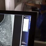 medicos-lancam-guia-para-evitar-recusa-de-mamografia-digital