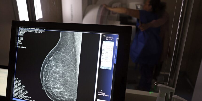 medicos-lancam-guia-para-evitar-recusa-de-mamografia-digital